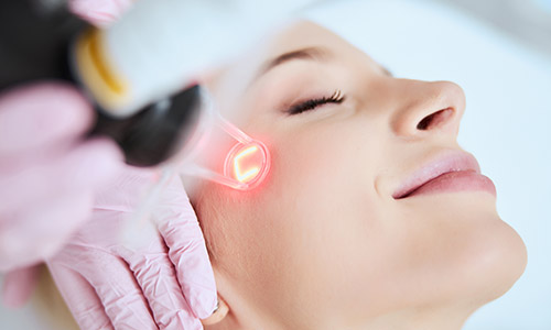 Laser Treatment